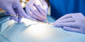 Bariatric-Surgery-Requirements