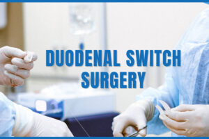 duodenal switch surgery